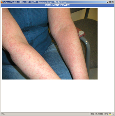 screenshot-dermatological photo